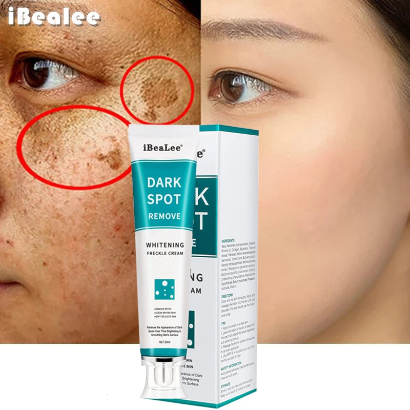 Remove Freckle Dark Spots Cream