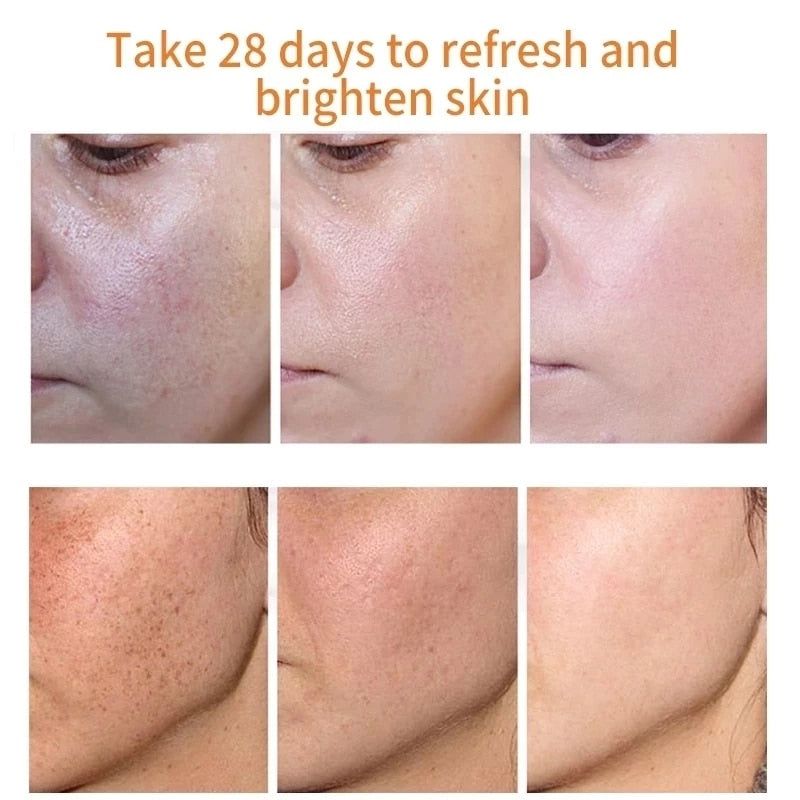 Remove Freckle Dark Spots Cream